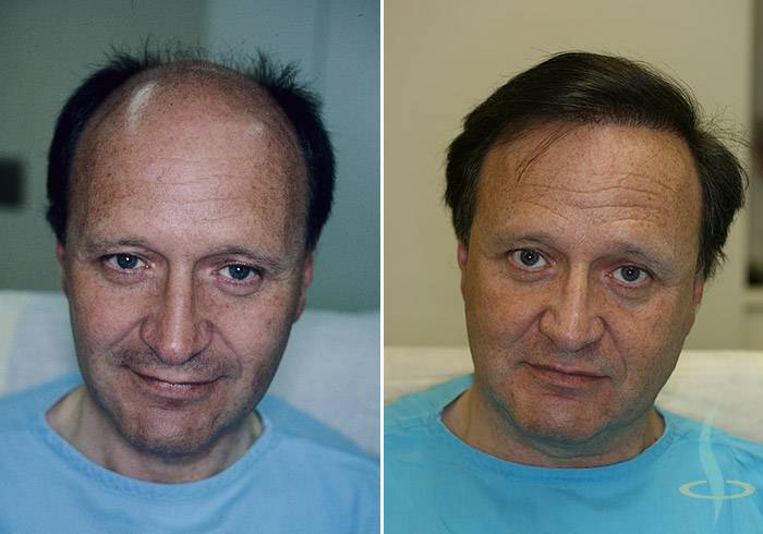 Слева: перед / справа: после 3-ой операции