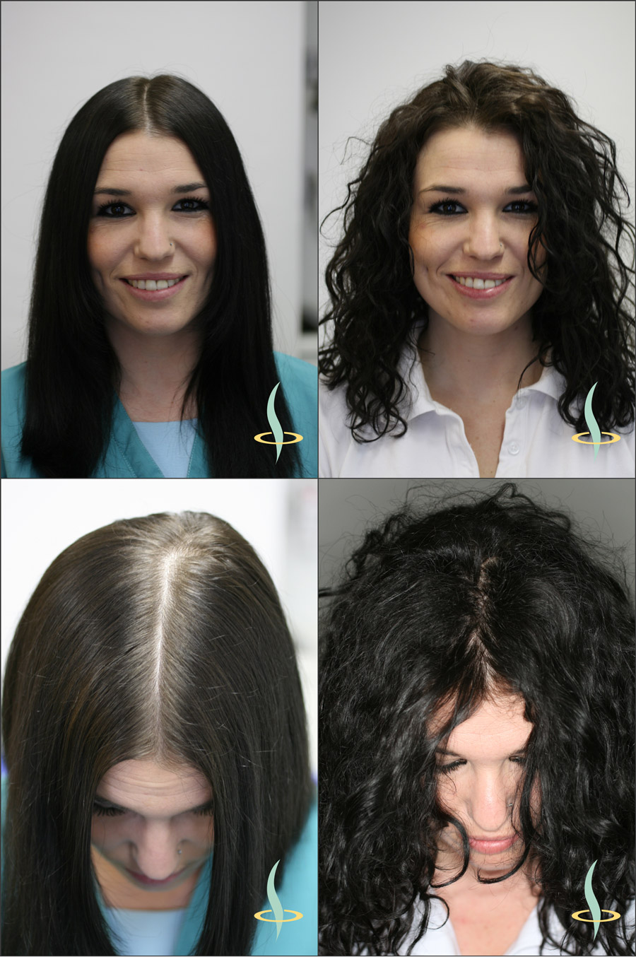 Рисунок 2: Оптический эффект видимости кожи головы при прямом (слева) и волнистом (справа) волосе.