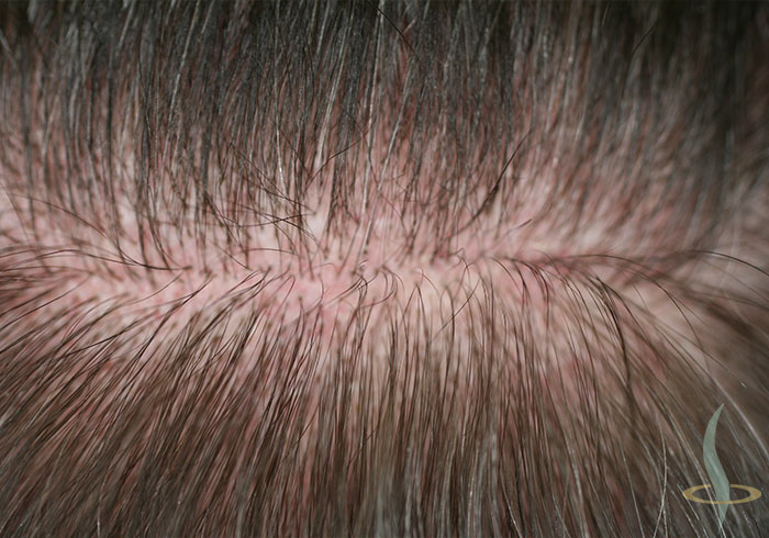 Пункт сбора